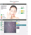 200X HD Camera Analysis Skin Moisture Skin Care Analyzer Portable OEM