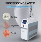 755nm Mole Picosecond Laser Machine Co2 Laser Freckle Removal
