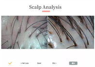 3 Spectrum Scalp Analyzer Detector Portable Scalp Hair Follicle 720P 1080P